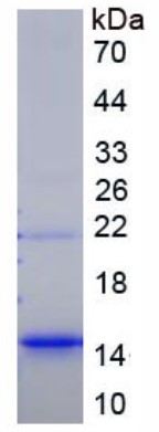 SDS-PAGE (CXCL16-881H).jpg